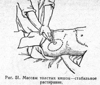 Массаж толстых кишок—стабильное растирание